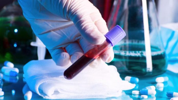 coronaviris dolj, coronavirus